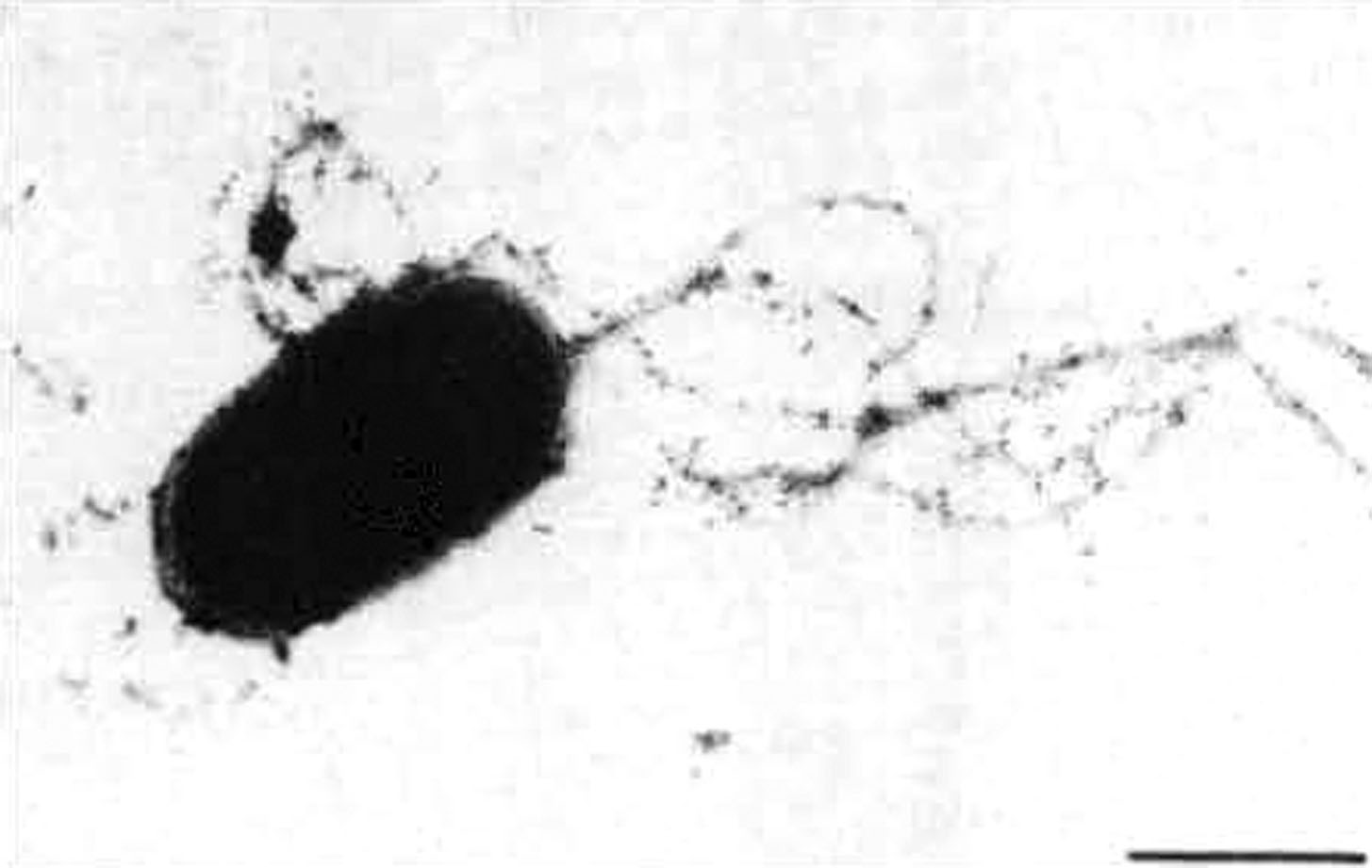 ဆောင်းပါး