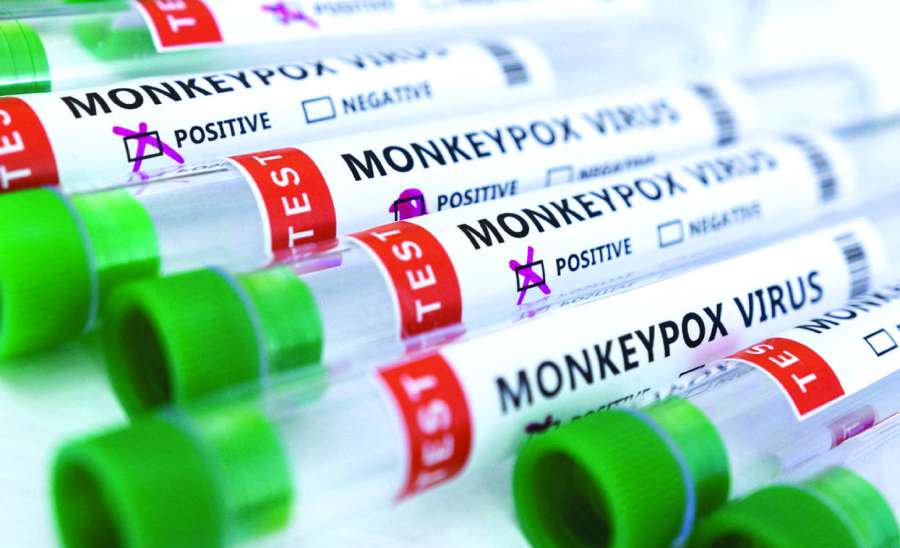 ဆောင်းပါး