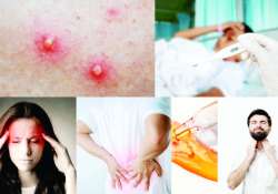 ဆောင်းပါး