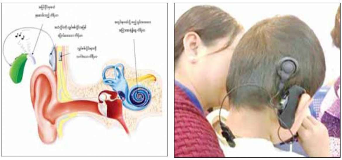 ဆောင်းပါး